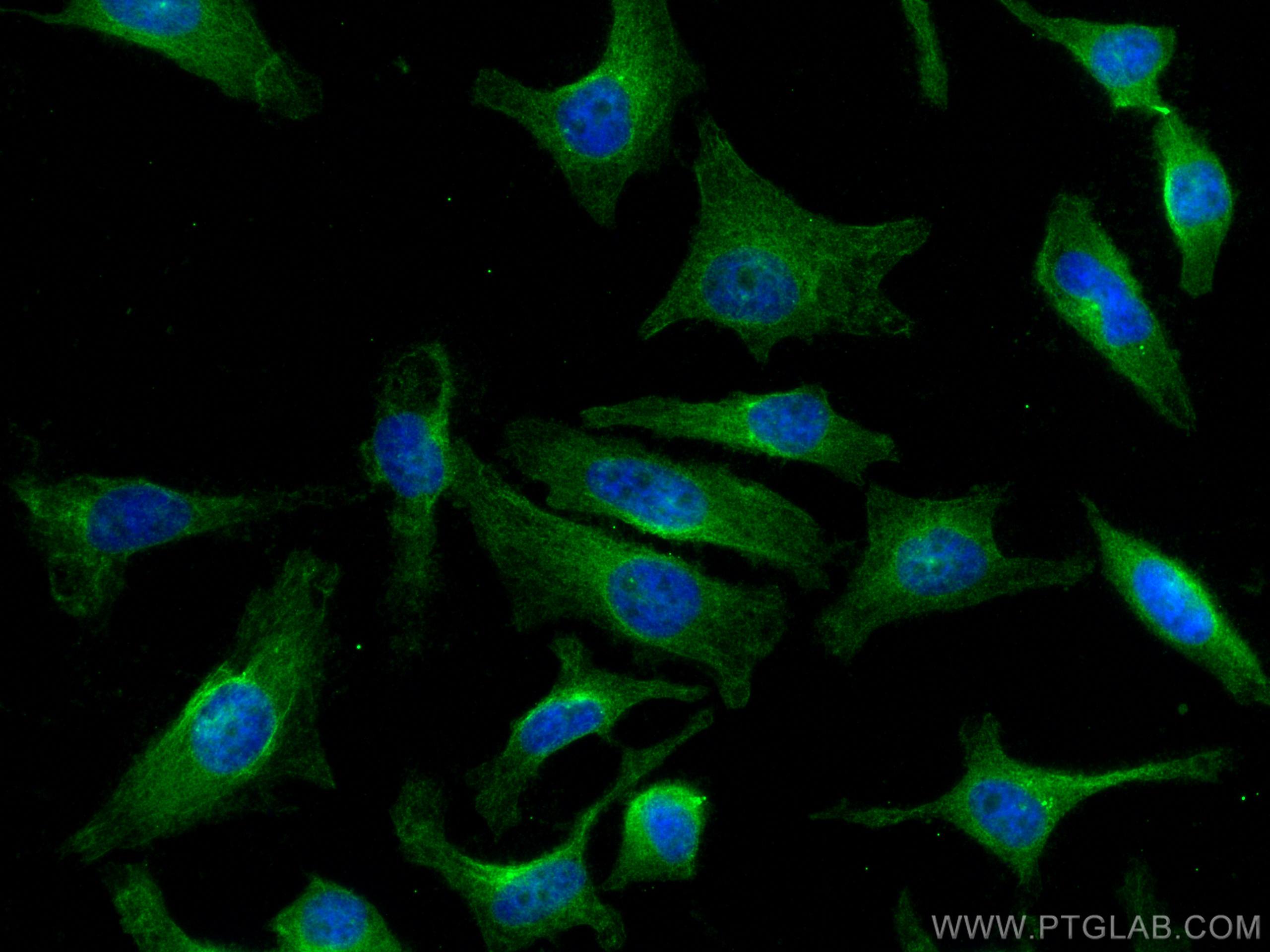 IF Staining of HeLa using 67706-1-Ig (same clone as 67706-1-PBS)