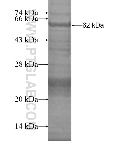 LAMC3-Specific fusion protein Ag19464 SDS-PAGE LAMC3-Specific fusion protein Ag19464 SDS-PAGE