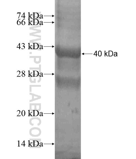 LAMC3-Specific fusion protein Ag19465 SDS-PAGE LAMC3-Specific fusion protein Ag19465 SDS-PAGE