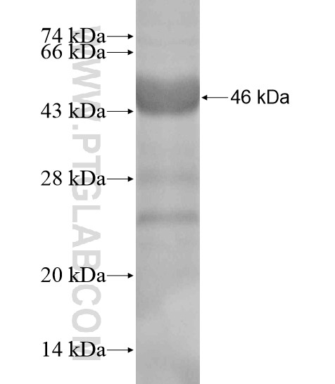 LAMC3-Specific fusion protein Ag19613 SDS-PAGE LAMC3-Specific fusion protein Ag19613 SDS-PAGE