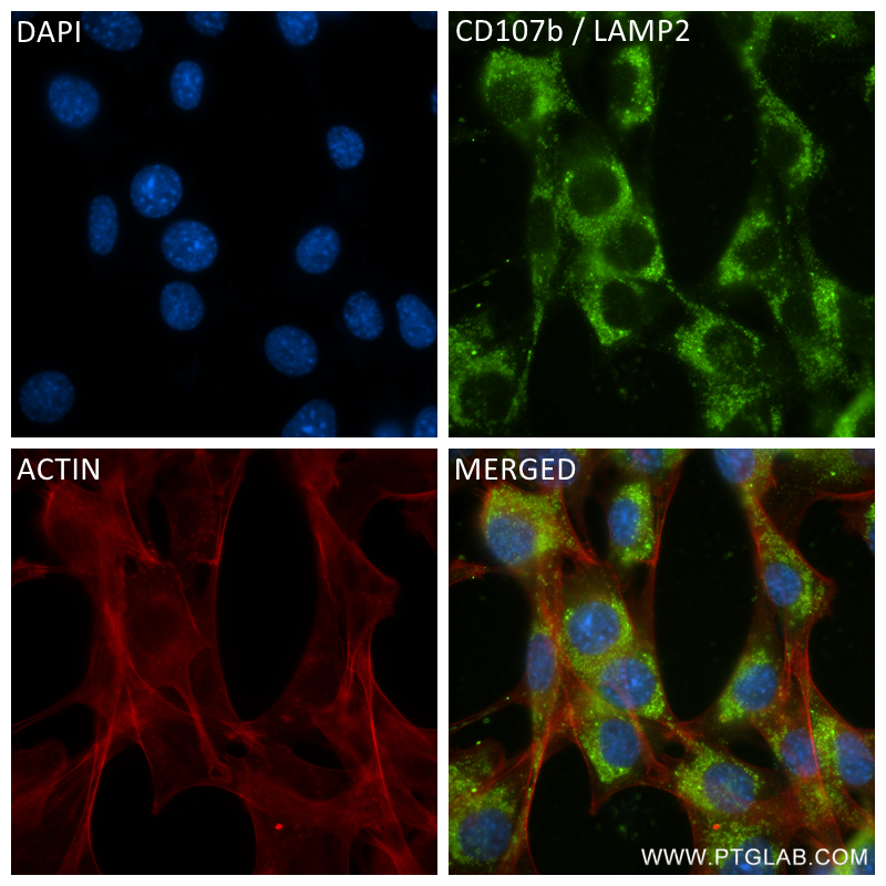 IF Staining of NIH/3T3 using 84474-7-RR