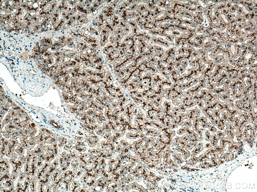 IHC staining of human liver using 27823-1-AP
