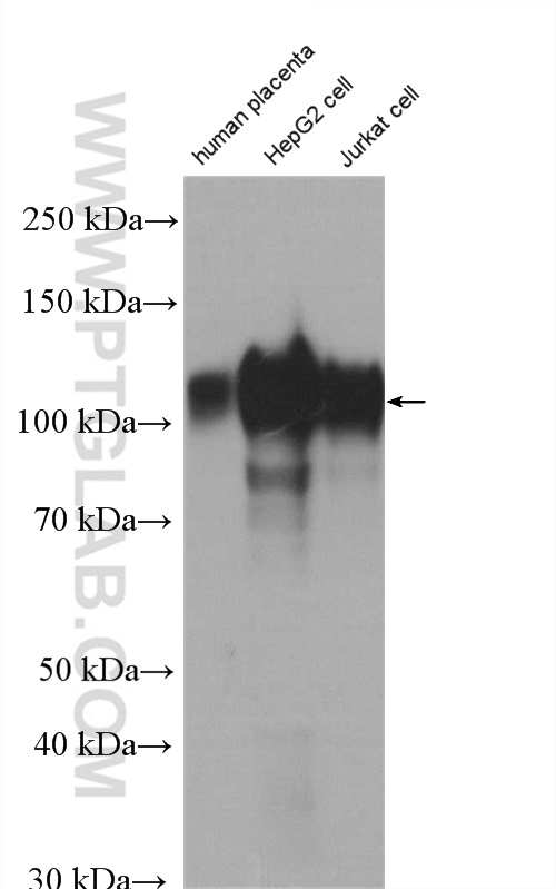 CD107b / LAMP2