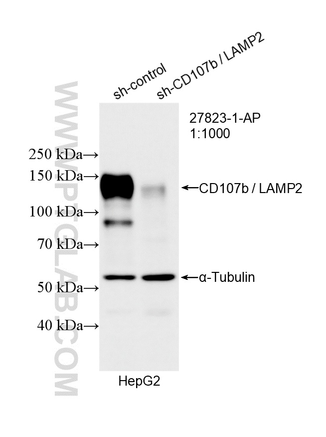 WB result of CD107b / LAMP2 antibody (27823-1-AP; 1:1000; incubated at room temperature for 1.5 hours) with sh-Control and sh-CD107b / LAMP2 transfected HepG2 cells. WB analysis of HepG2 using 27823-1-AP