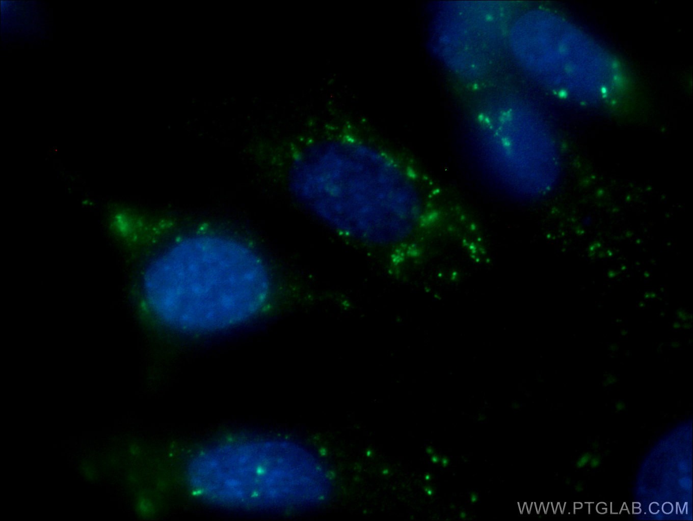 CD107b / LAMP2
