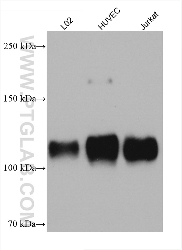 WB analysis using 66301-1-Ig (same clone as 66301-1-PBS)