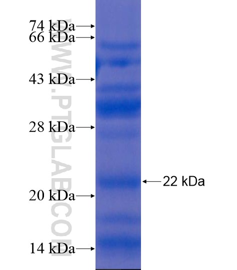LAMP2 fusion protein Ag20360 SDS-PAGE LAMP2 fusion protein Ag20360 SDS-PAGE
