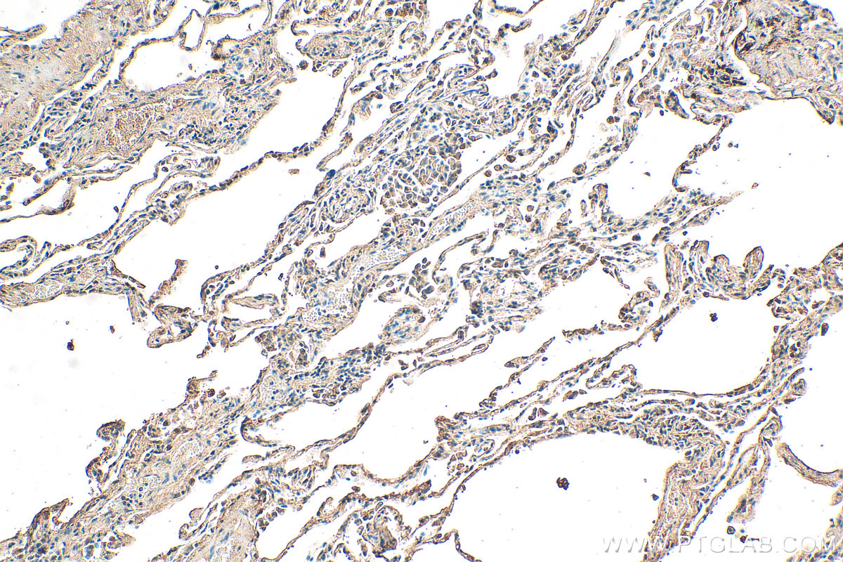IHC staining of human lung using 12632-1-AP