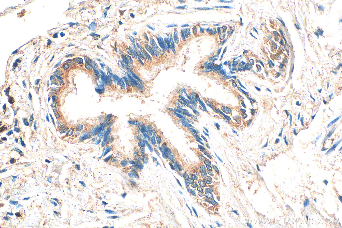 IHC staining of human lung using 12632-1-AP