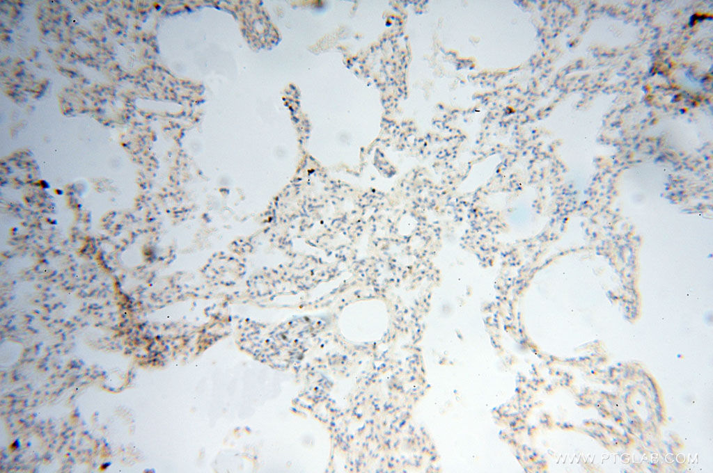 IHC staining of human lung using 12632-1-AP