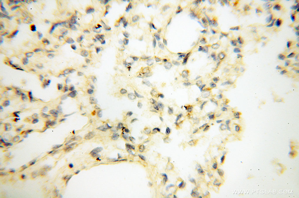 IHC staining of human lung using 12632-1-AP
