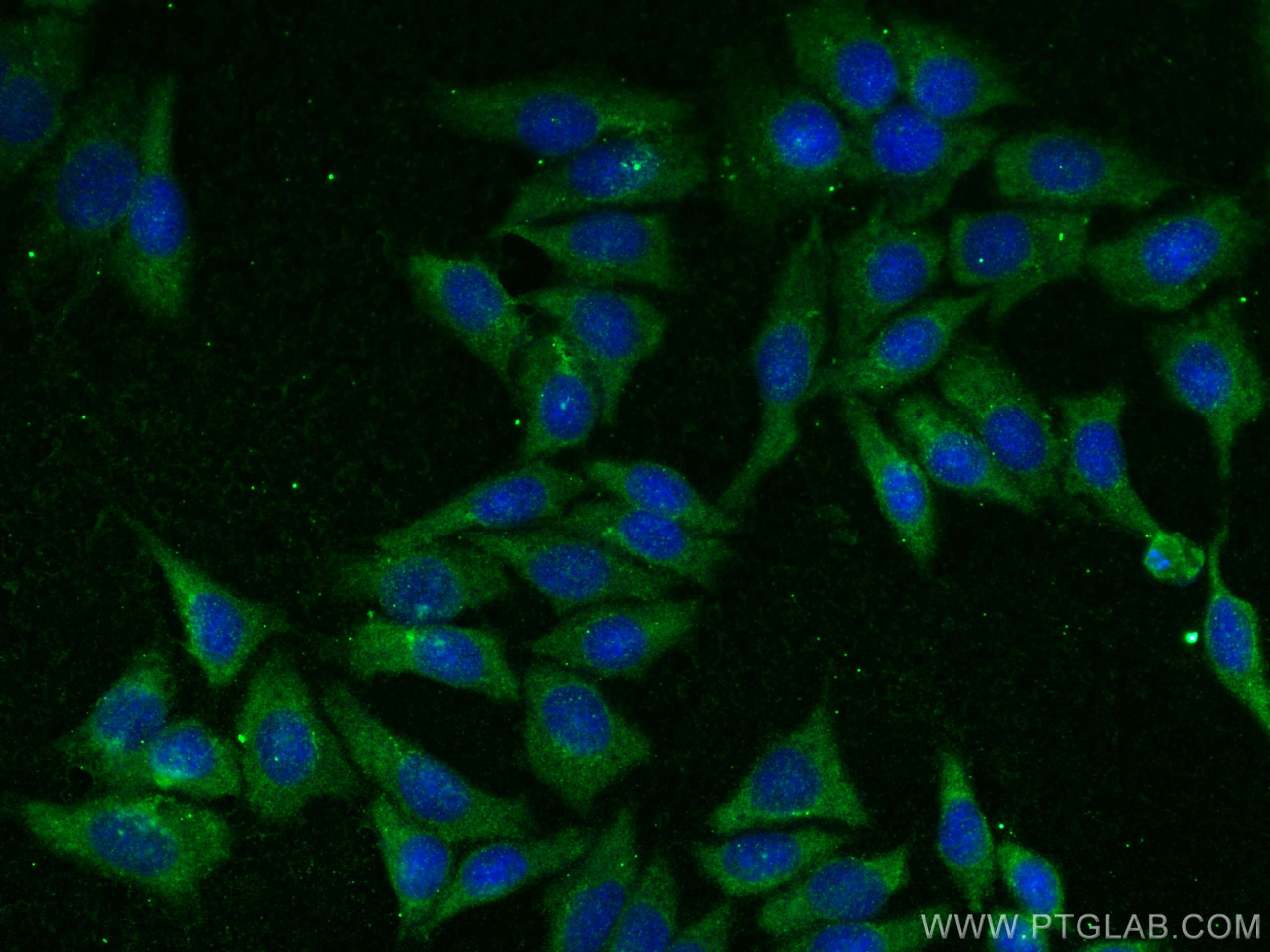 IF Staining of HepG2 using 14533-1-AP