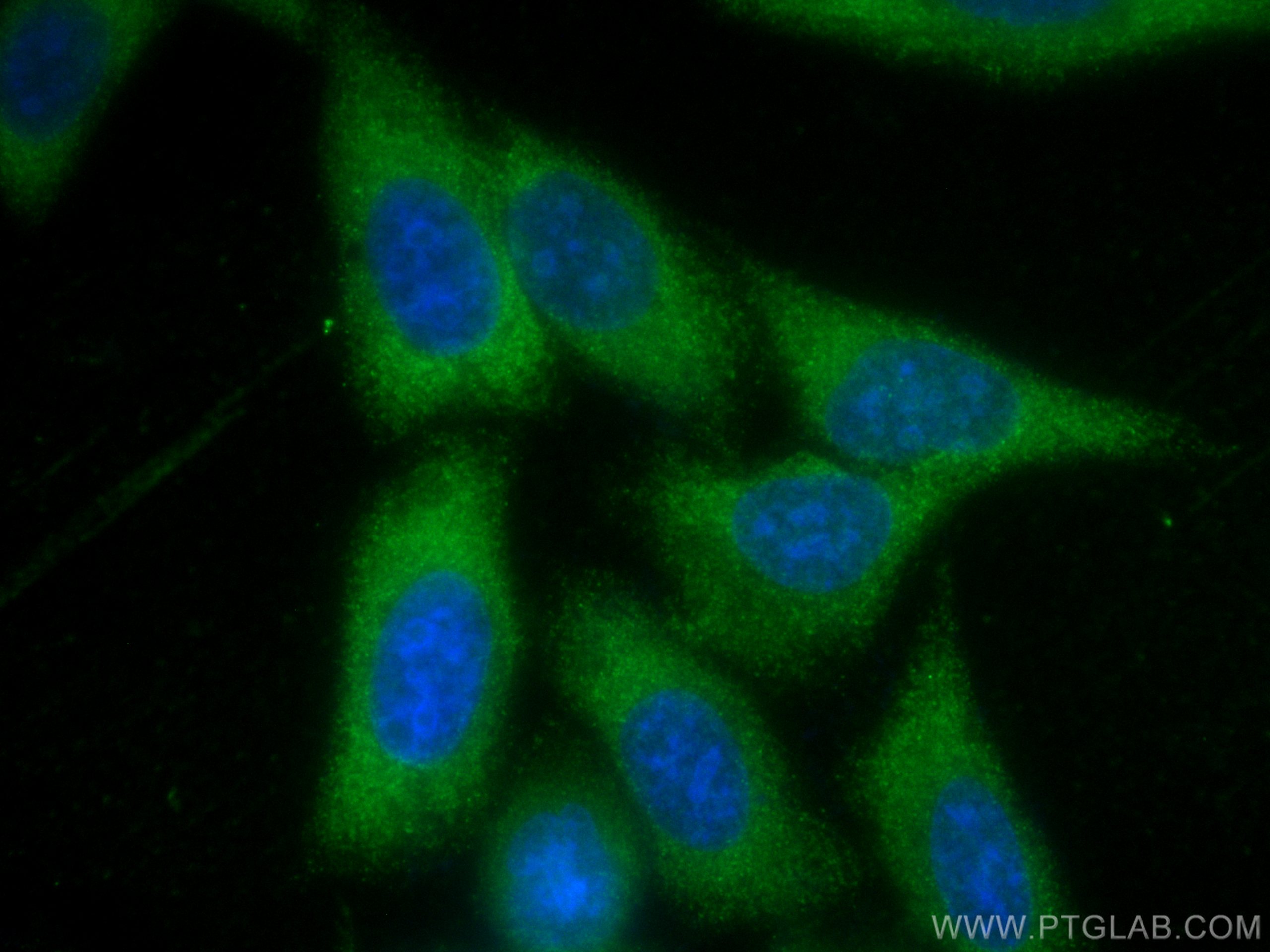 IF Staining of HepG2 using 67324-1-Ig (same clone as 67324-1-PBS)