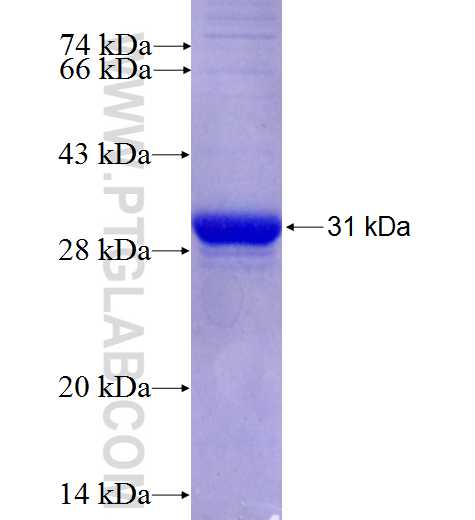 LANCL3 fusion protein Ag26976 SDS-PAGE LANCL3 fusion protein Ag26976 SDS-PAGE