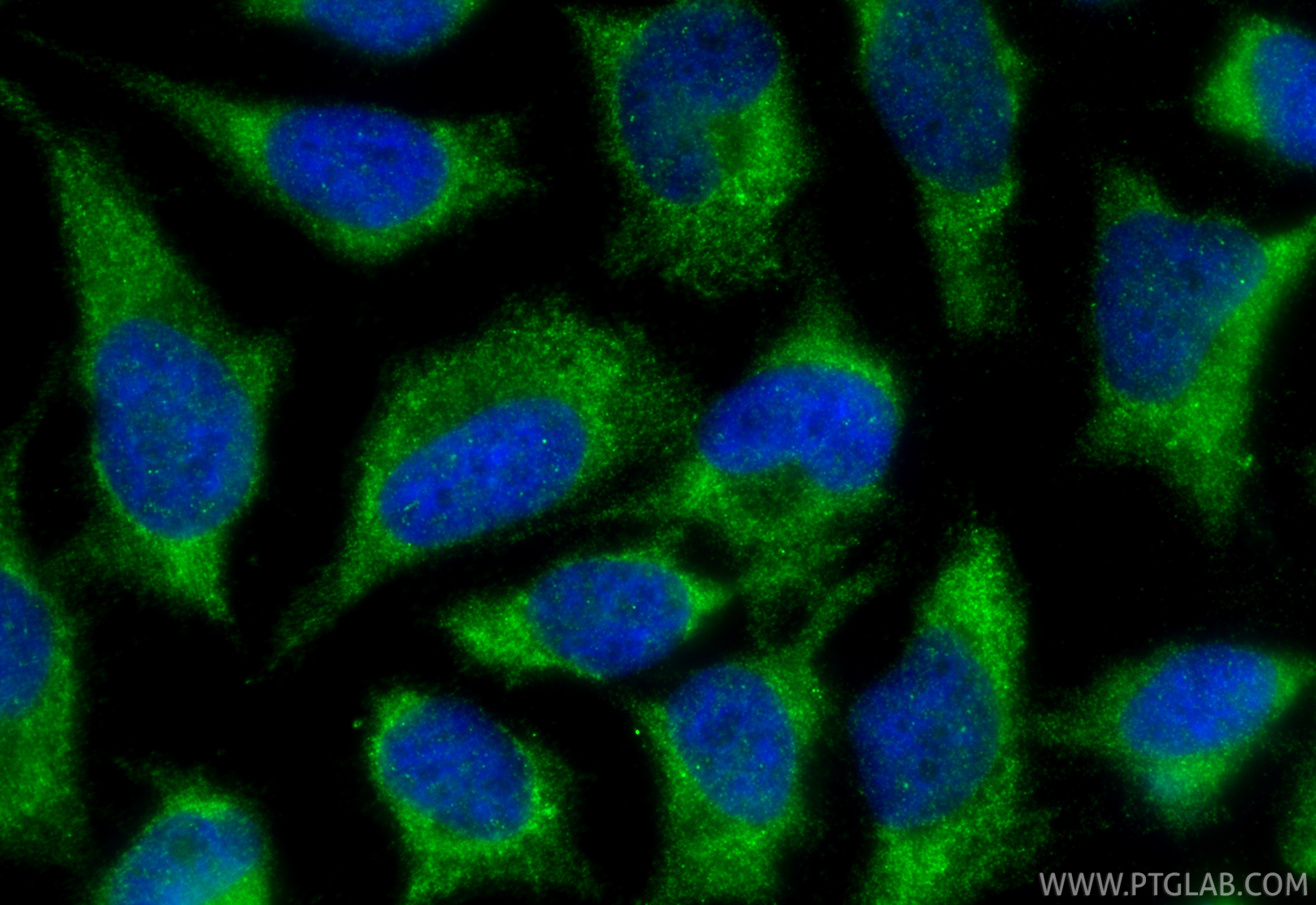IF Staining of HeLa using 14612-1-AP IF Staining of HeLa using 14612-1-AP