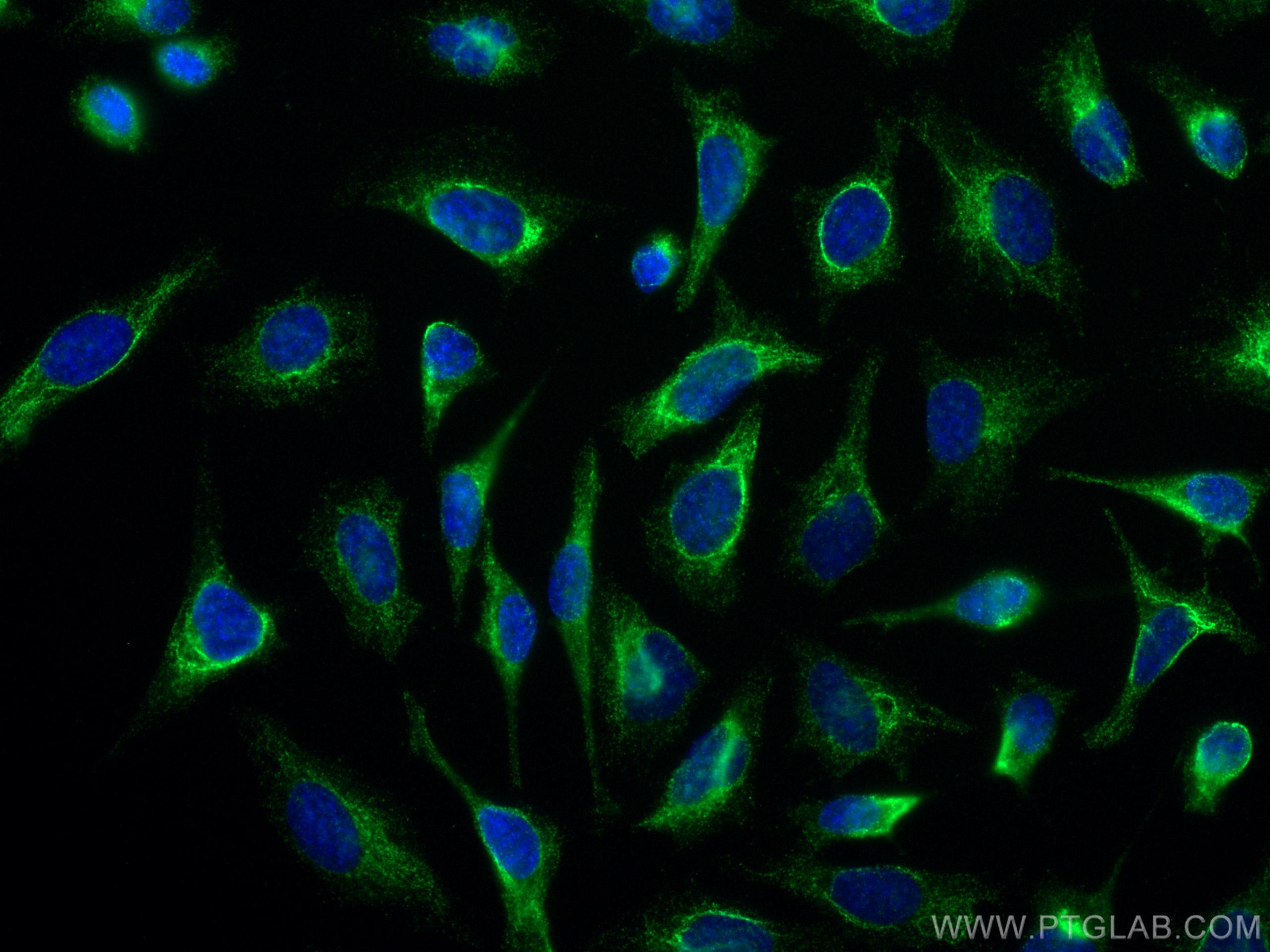 IF Staining of HeLa using 66417-1-Ig