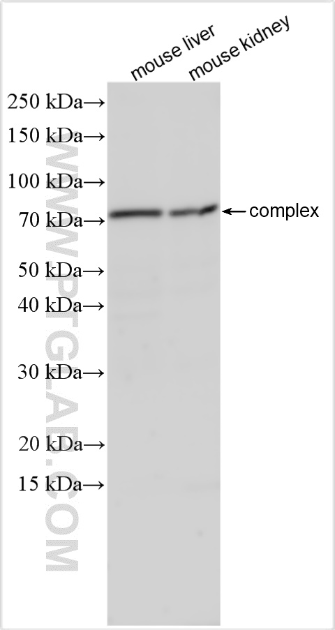 WB analysis using 30627-1-AP