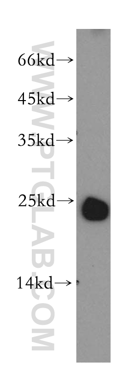 WB analysis of mouse lymph using 18895-1-AP