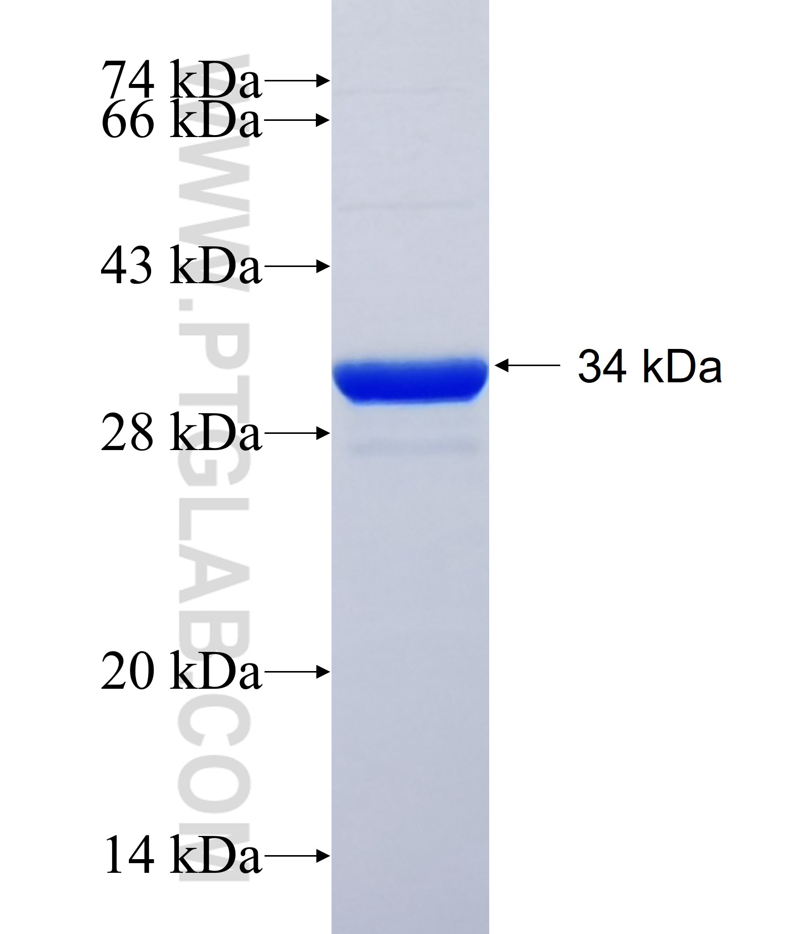 LAPTM5 fusion protein Ag30809 SDS-PAGE LAPTM5 fusion protein Ag30809 SDS-PAGE