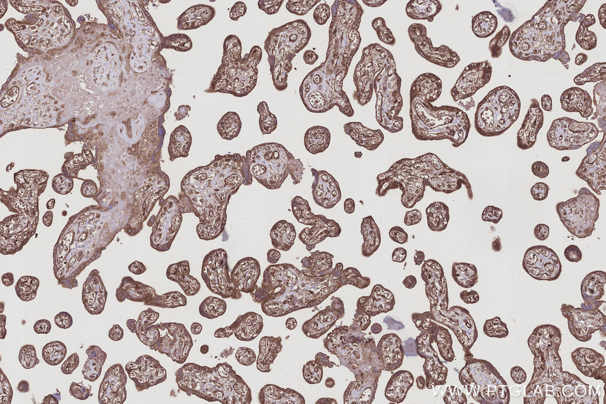 IHC staining of human placenta using 22441-1-AP IHC staining of human placenta using 22441-1-AP
