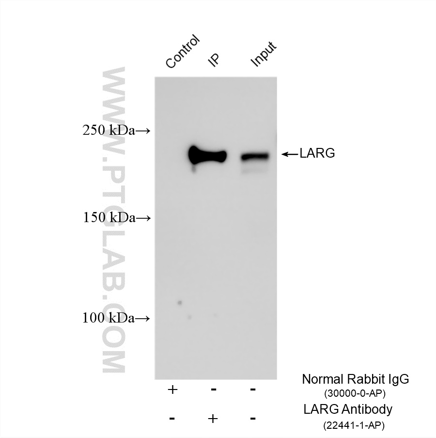 IP experiment of HEK-293 using 22441-1-AP