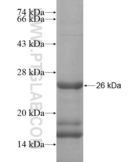 LARGE fusion protein Ag19470 SDS-PAGE LARGE fusion protein Ag19470 SDS-PAGE