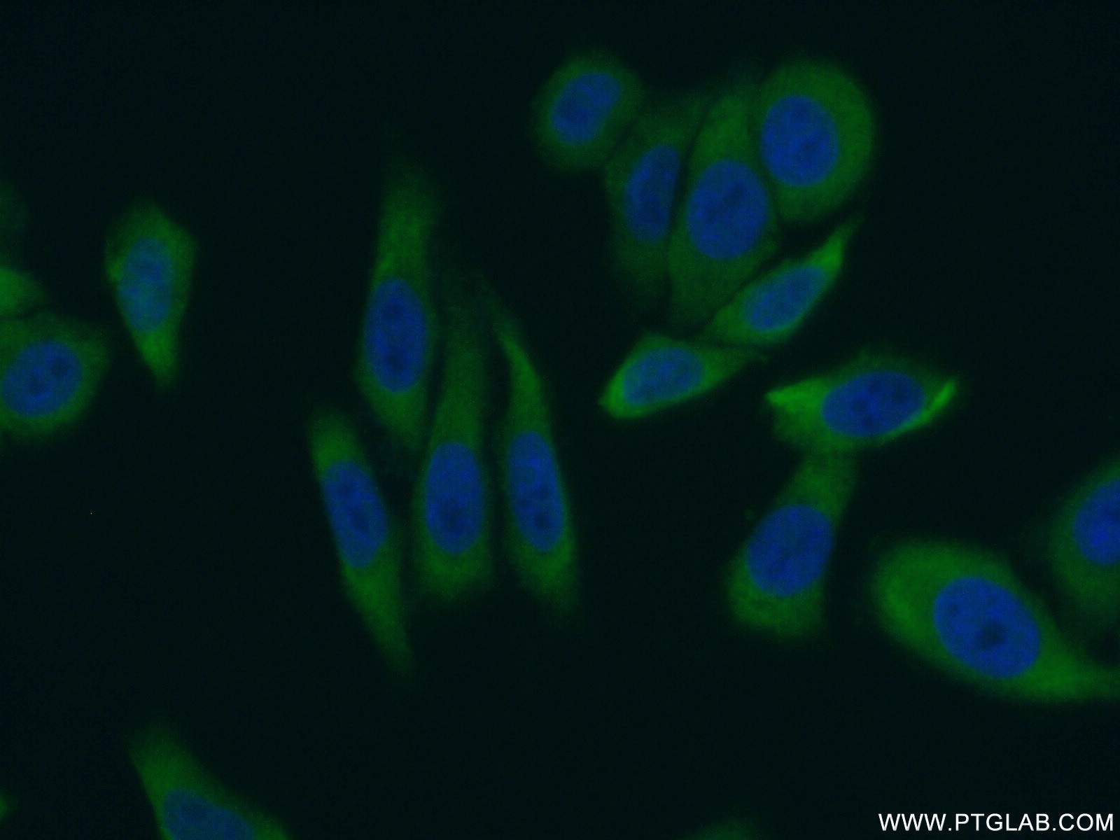 IF Staining of HepG2 using 13708-1-AP