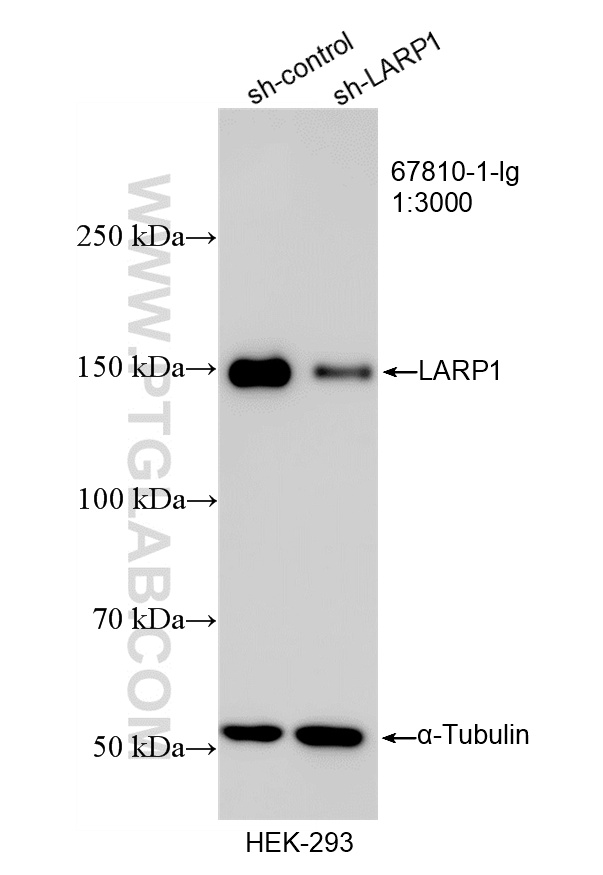 WB result of LARP1 antibody (67810-1-Ig; 1:3000; incubated at room temperature for 1.5 hours) with sh-Control and sh-LARP1 transfected HEK-293 cells. WB analysis of HEK-293 using 67810-1-Ig