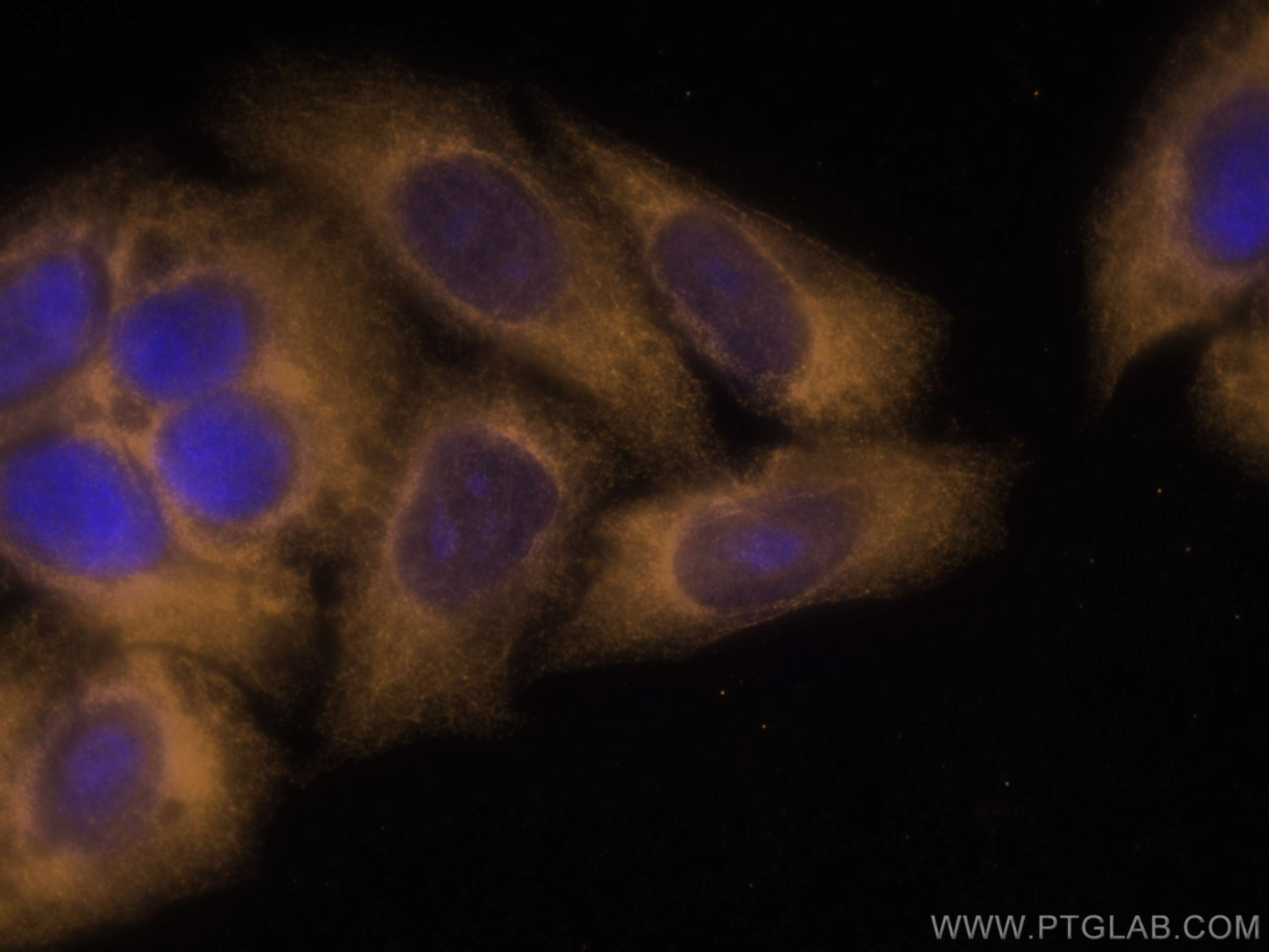 IF Staining of HepG2 using CL555-67810