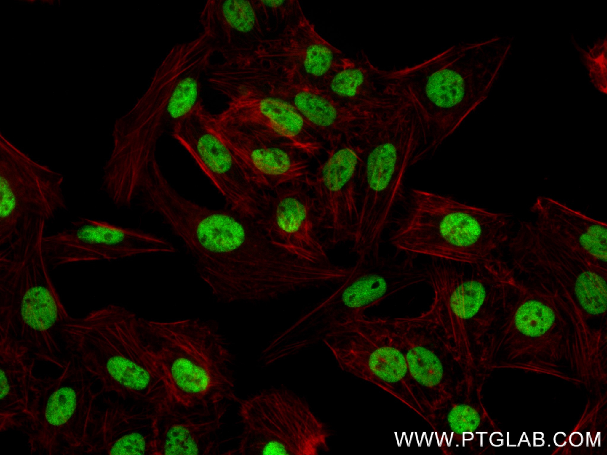 IF Staining of U2OS using 84898-3-RR (same clone as 84898-3-PBS)