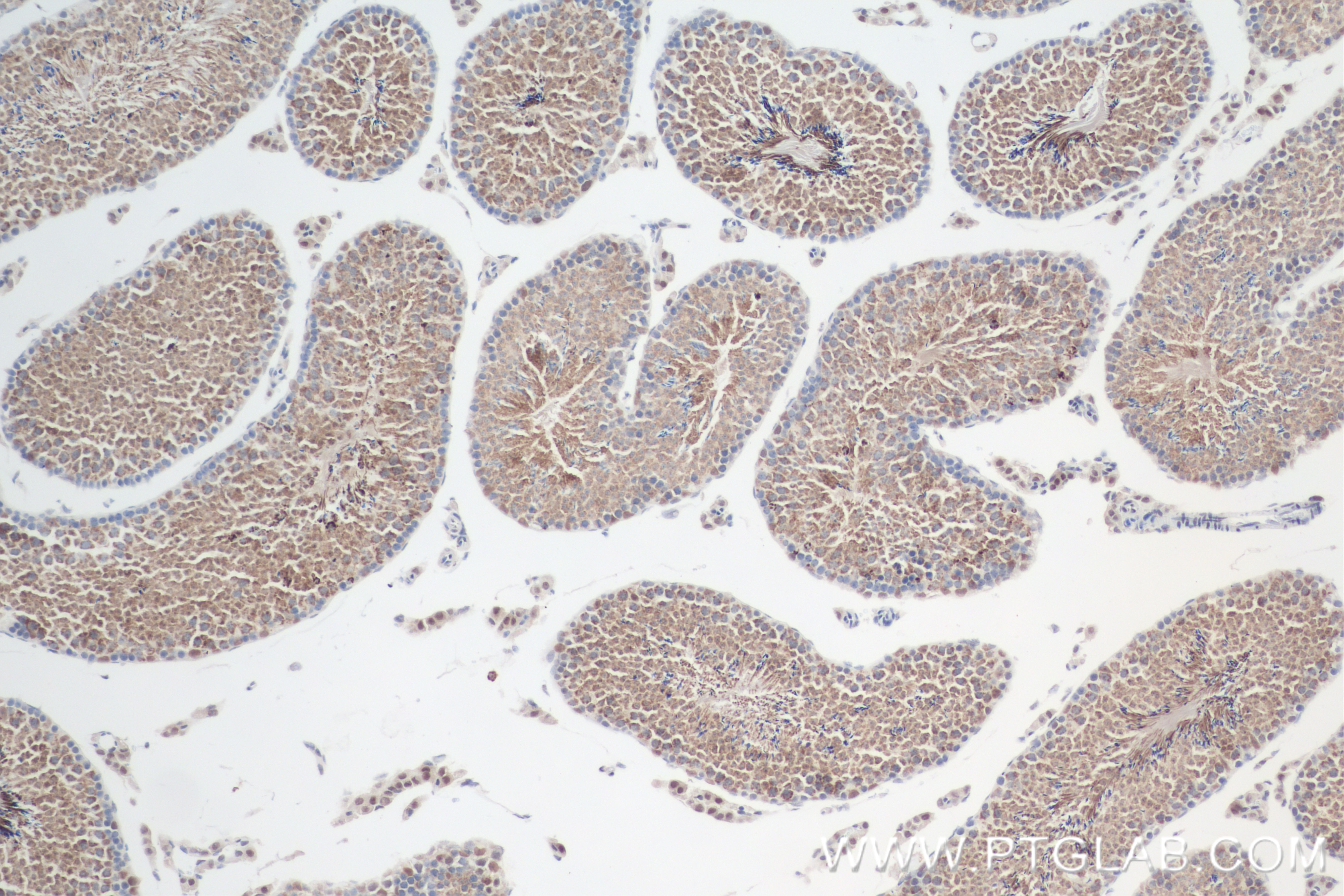 IHC staining of mouse testis using 84898-3-RR (same clone as 84898-3-PBS)