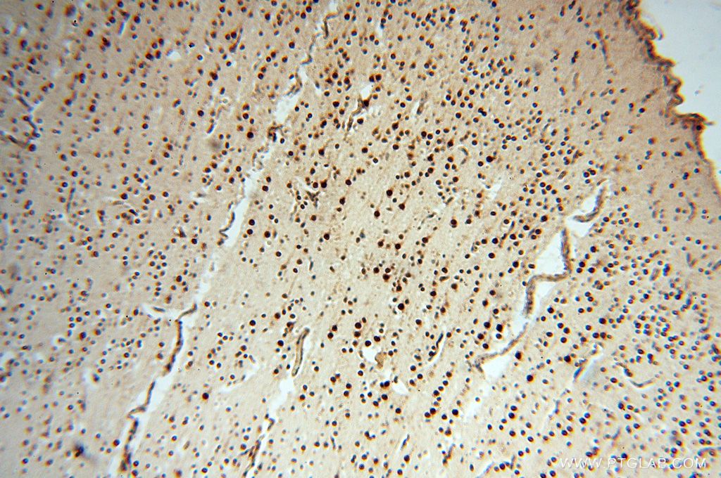 IHC staining of human brain using 16529-1-AP