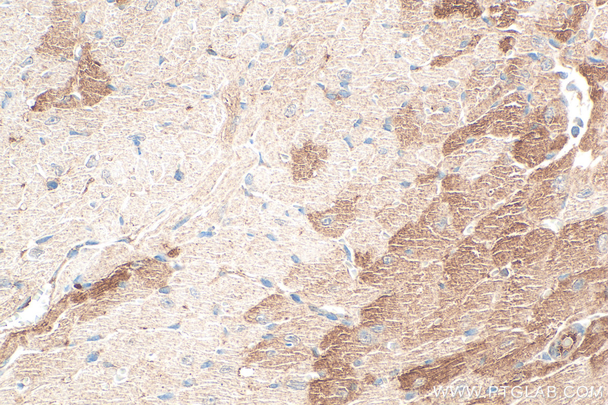 IHC staining of mouse heart using 27514-1-AP