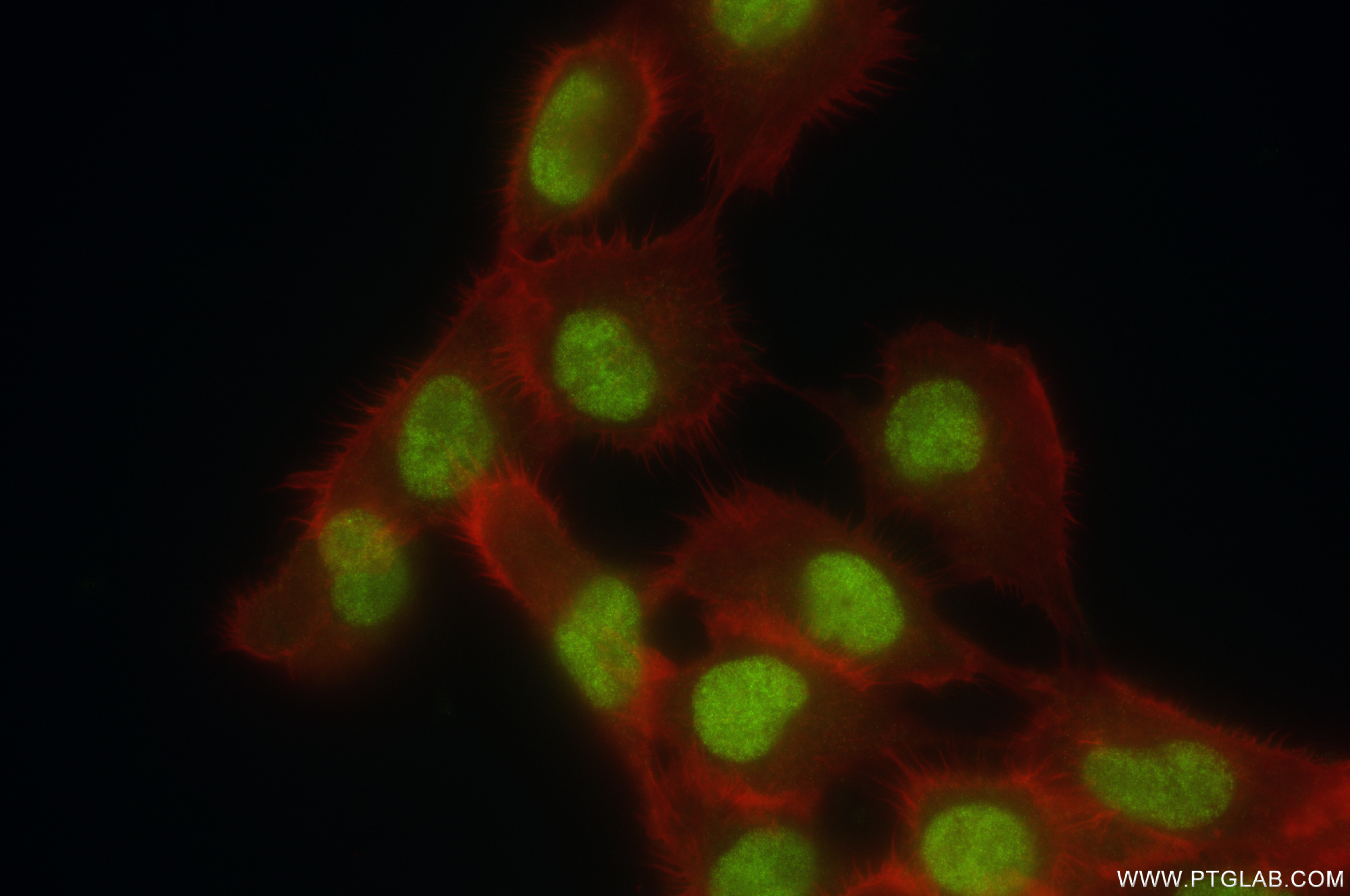 IF Staining of A431 using 84950-3-RR (same clone as 84950-3-PBS)