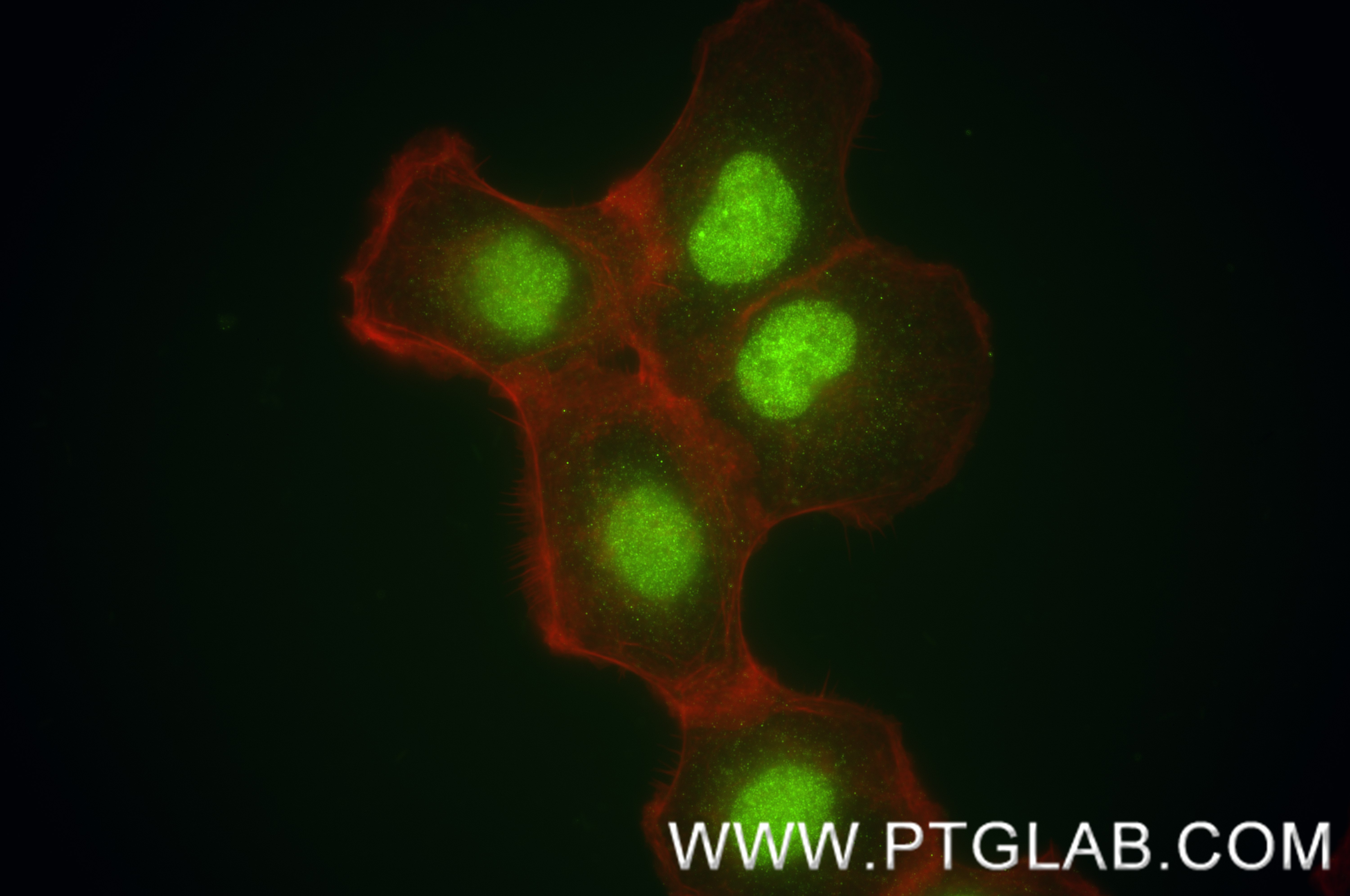 IF Staining of A431 using 84950-3-RR (same clone as 84950-3-PBS)