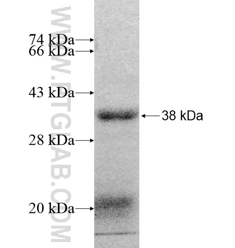 LARP7 fusion protein Ag10850 SDS-PAGE