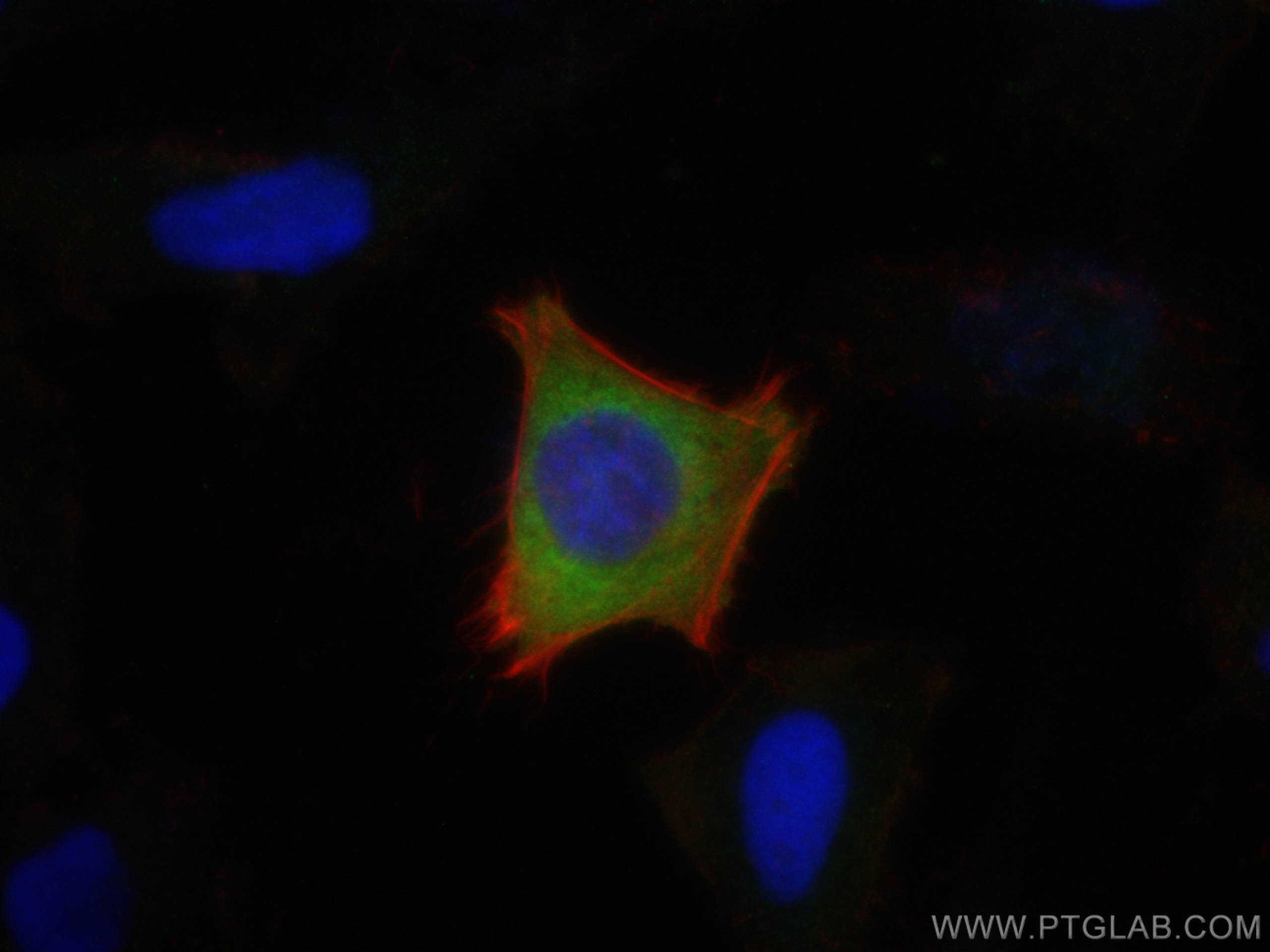 IF Staining of HeLa using 21146-1-AP