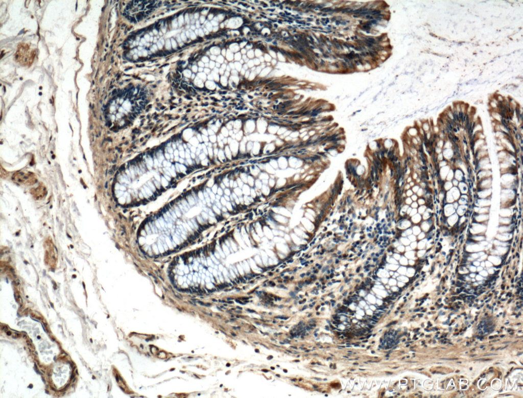 IHC staining of human colon using 21146-1-AP