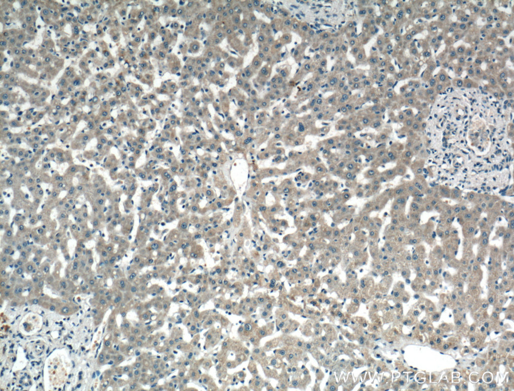 IHC staining of human liver using 20344-1-AP