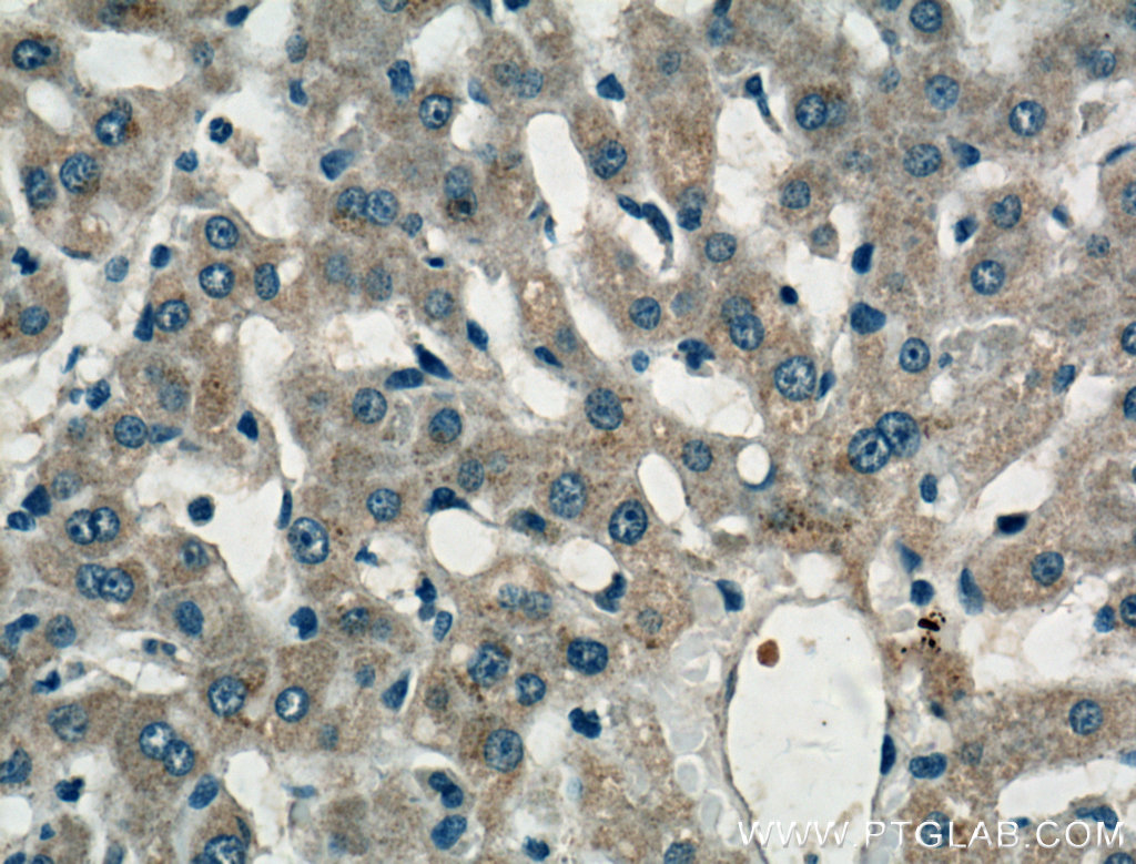 IHC staining of human liver using 20344-1-AP