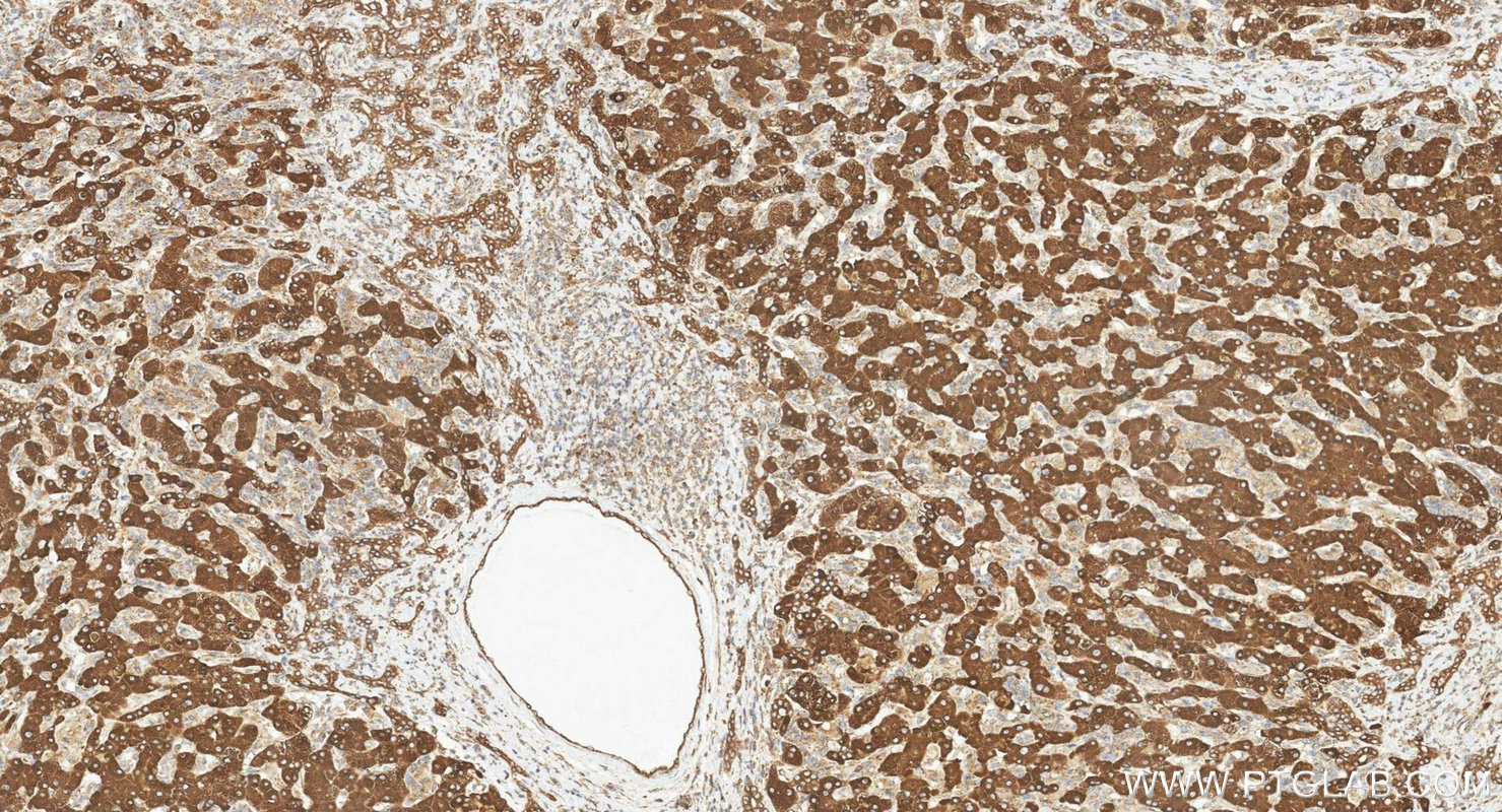 IHC staining of human liver using 20344-1-AP IHC staining of human liver using 20344-1-AP