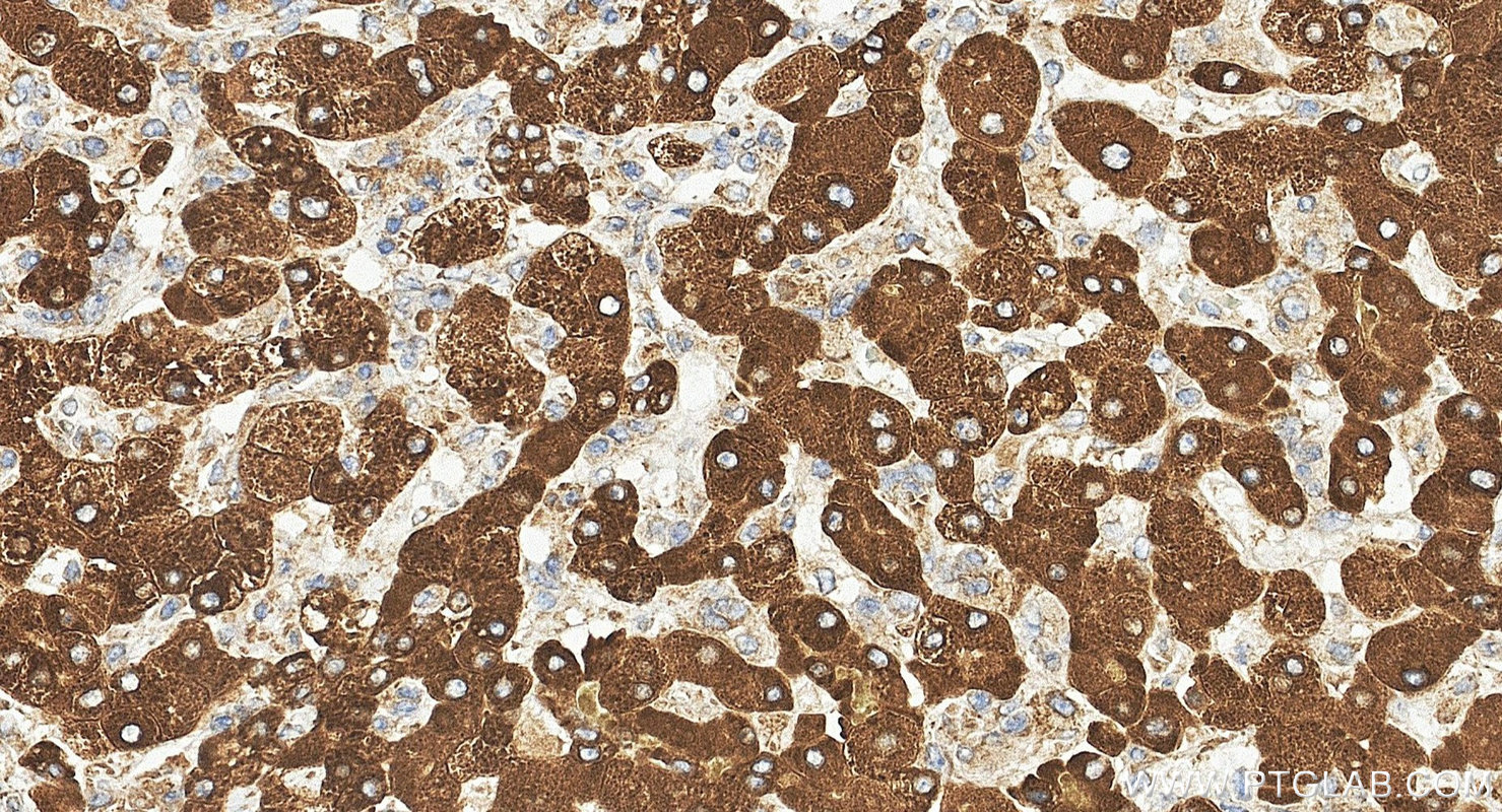 IHC staining of human liver using 20344-1-AP IHC staining of human liver using 20344-1-AP