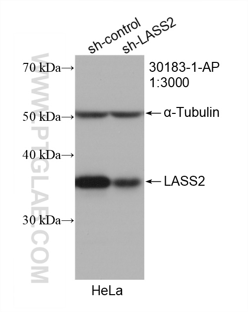 WB analysis of HeLa using 30183-1-AP