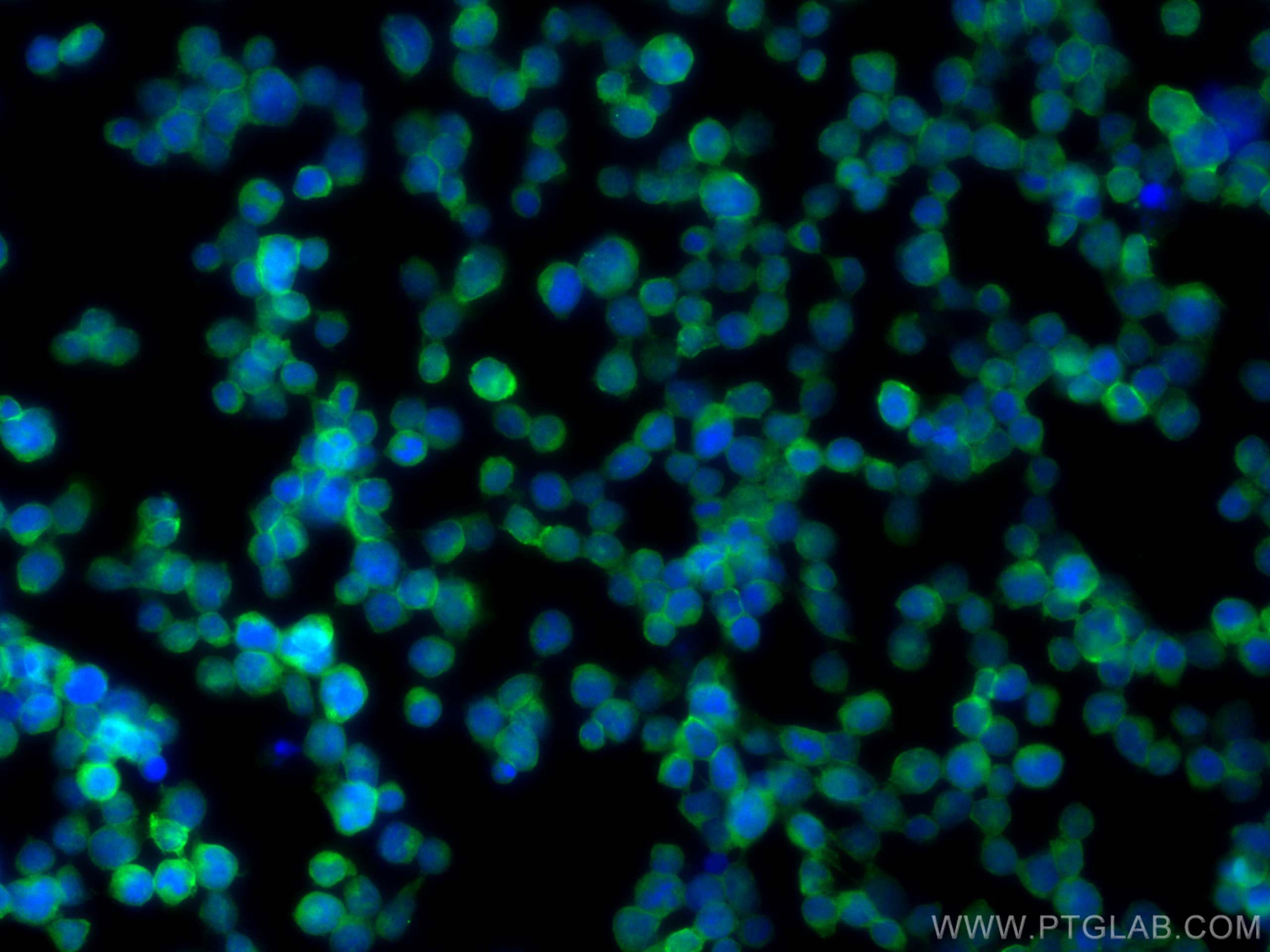 IF Staining of Jurkat using 11326-1-AP