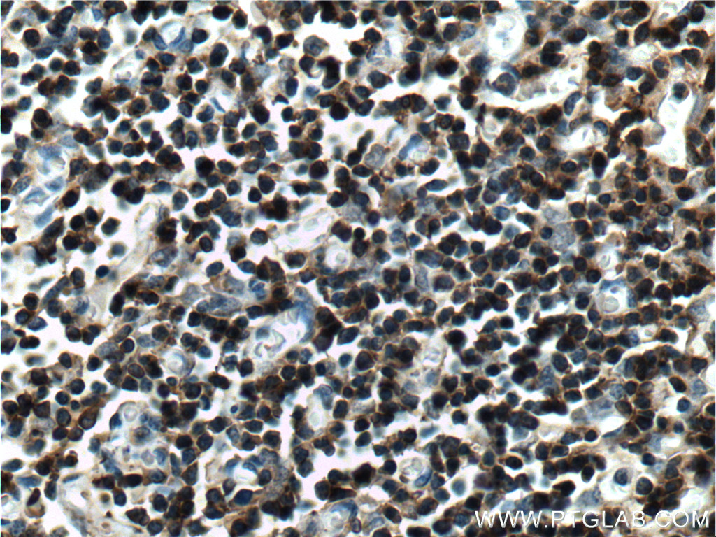IHC staining of human thymus using 11326-1-AP
