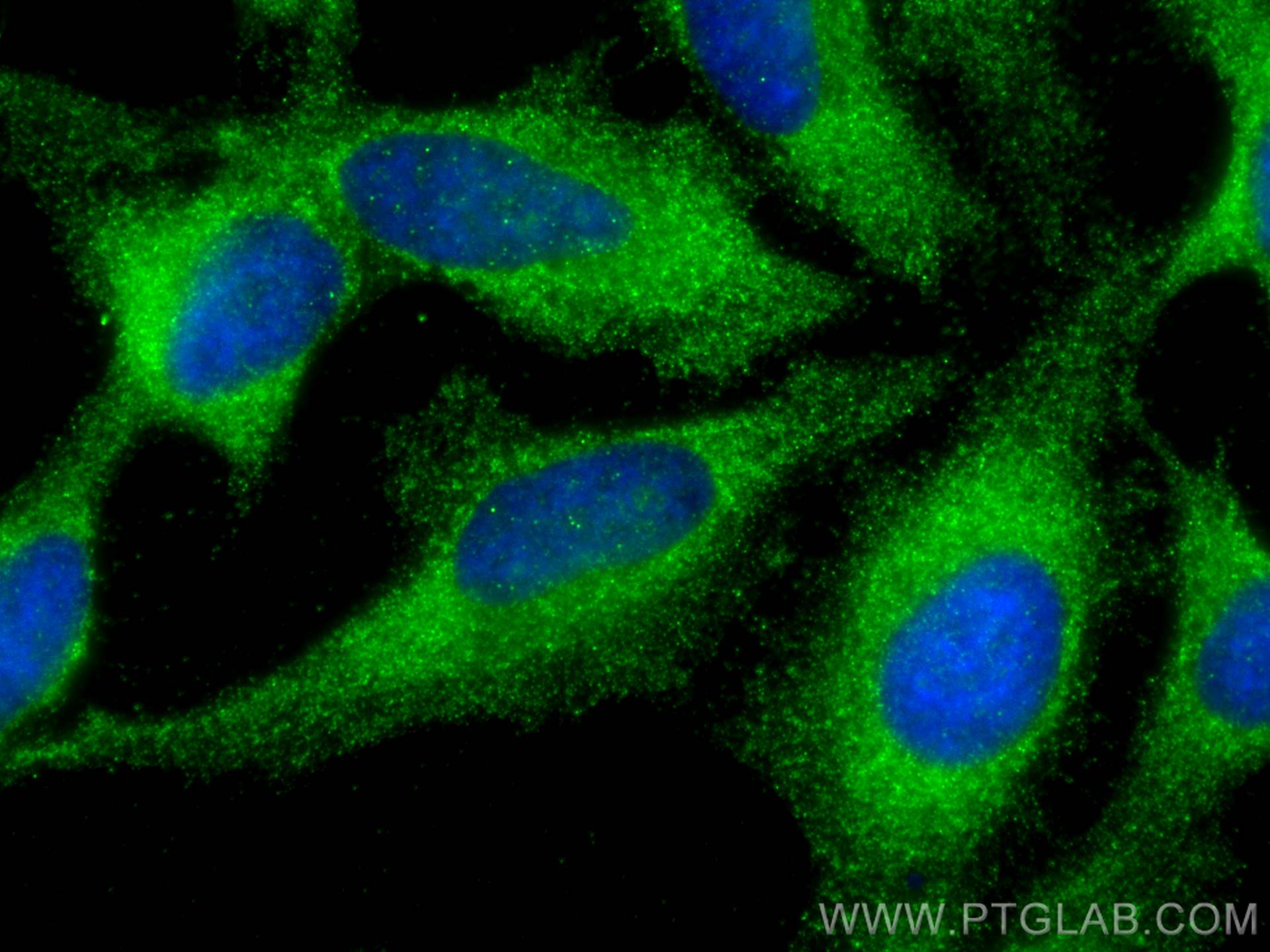 IF Staining of HeLa using 17049-1-AP