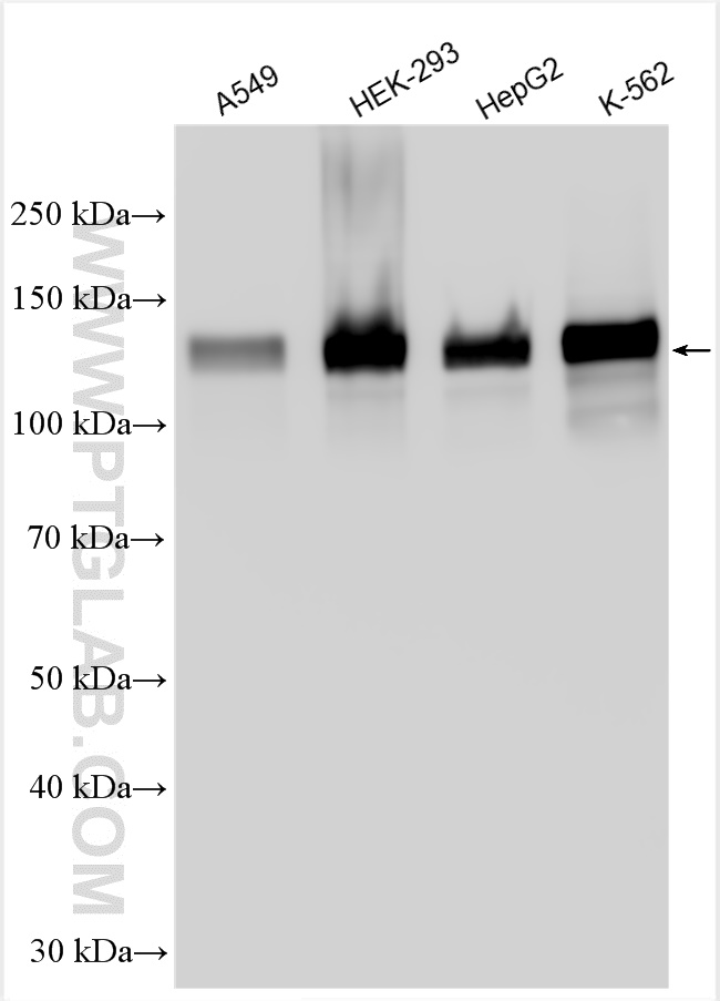 WB analysis using 30174-1-AP