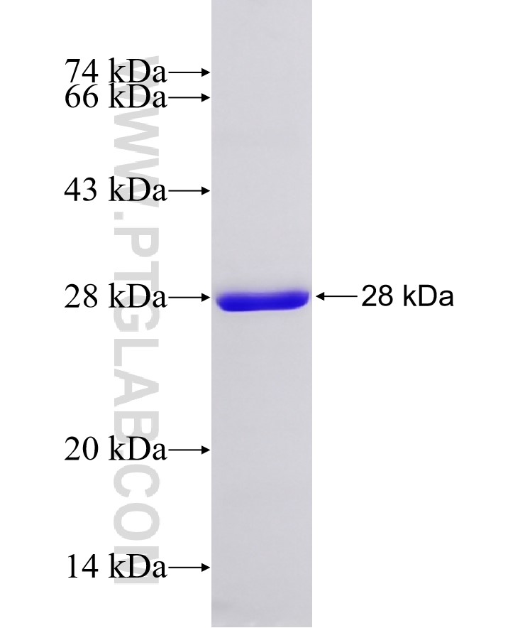 LATS1 fusion protein Ag33203 SDS-PAGE LATS1 fusion protein Ag33203 SDS-PAGE