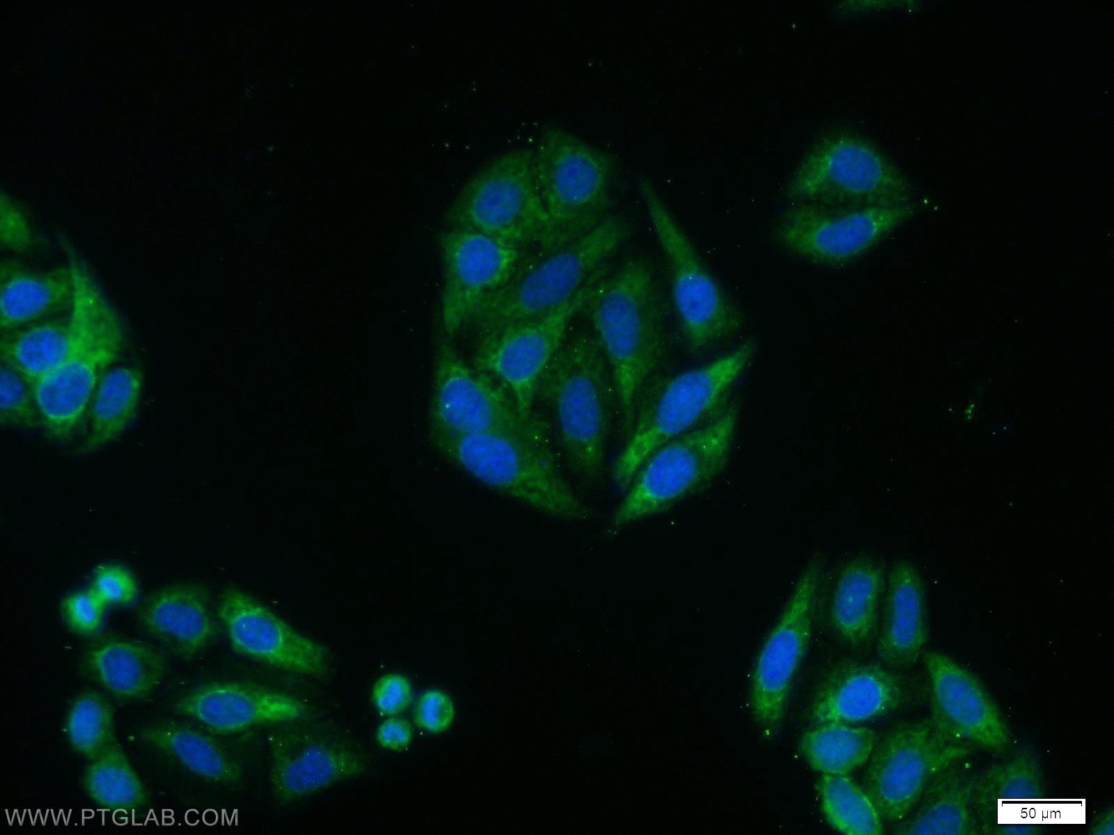 IF Staining of HepG2 using 20276-1-AP