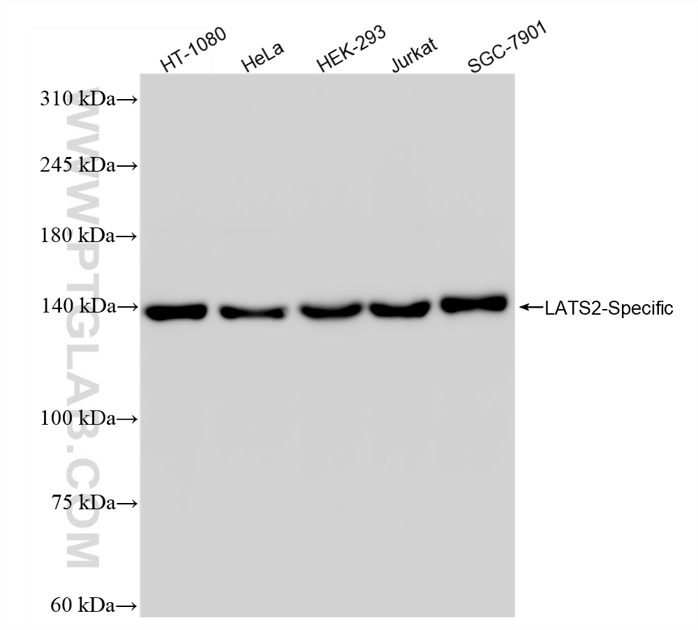 WB analysis using 88282-1-RR (same clone as 88282-1-PBS) WB analysis using 88282-1-RR (same clone as 88282-1-PBS)